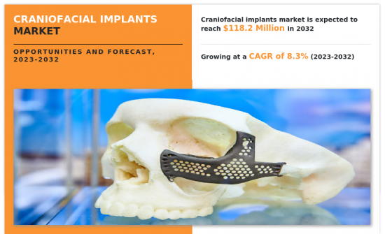 Craniofacial Implants Market - IMG1