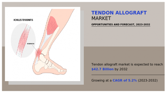 Tendon Allograft Market - IMG1