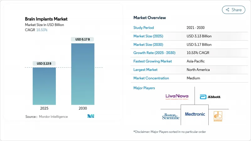 Brain Implants - Market - IMG1