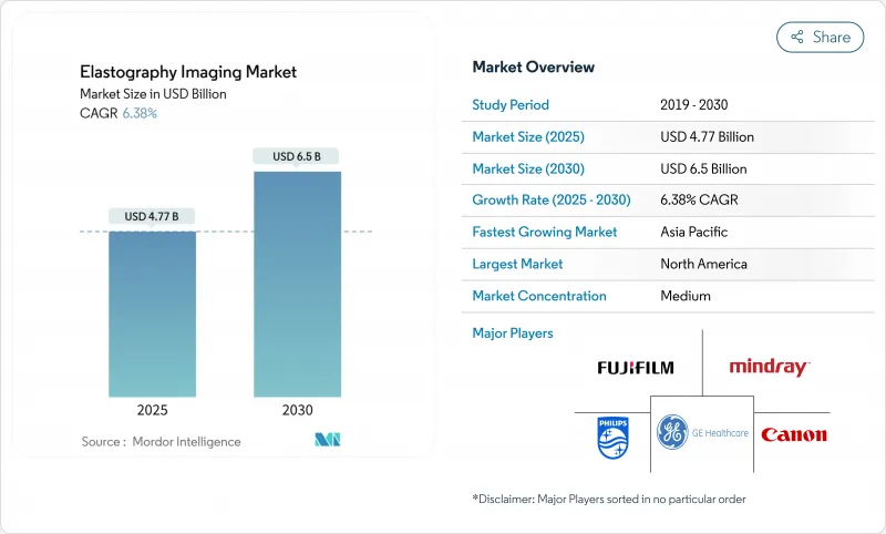 Elastography Imaging - Market - IMG1