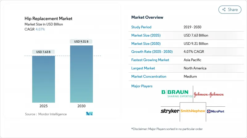 Hip Replacement - Market - IMG1